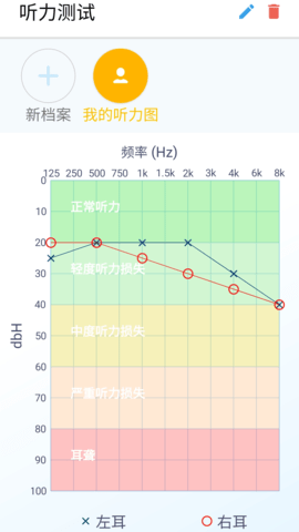 艾米助听（AmiHear）图3